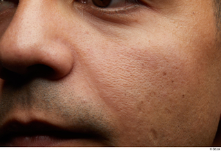 HD face Skin Juan Andino cheek face nose skin pores…